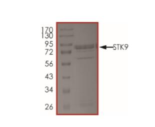 The purity of CDKL5 was determined to be >85% by densitometry.